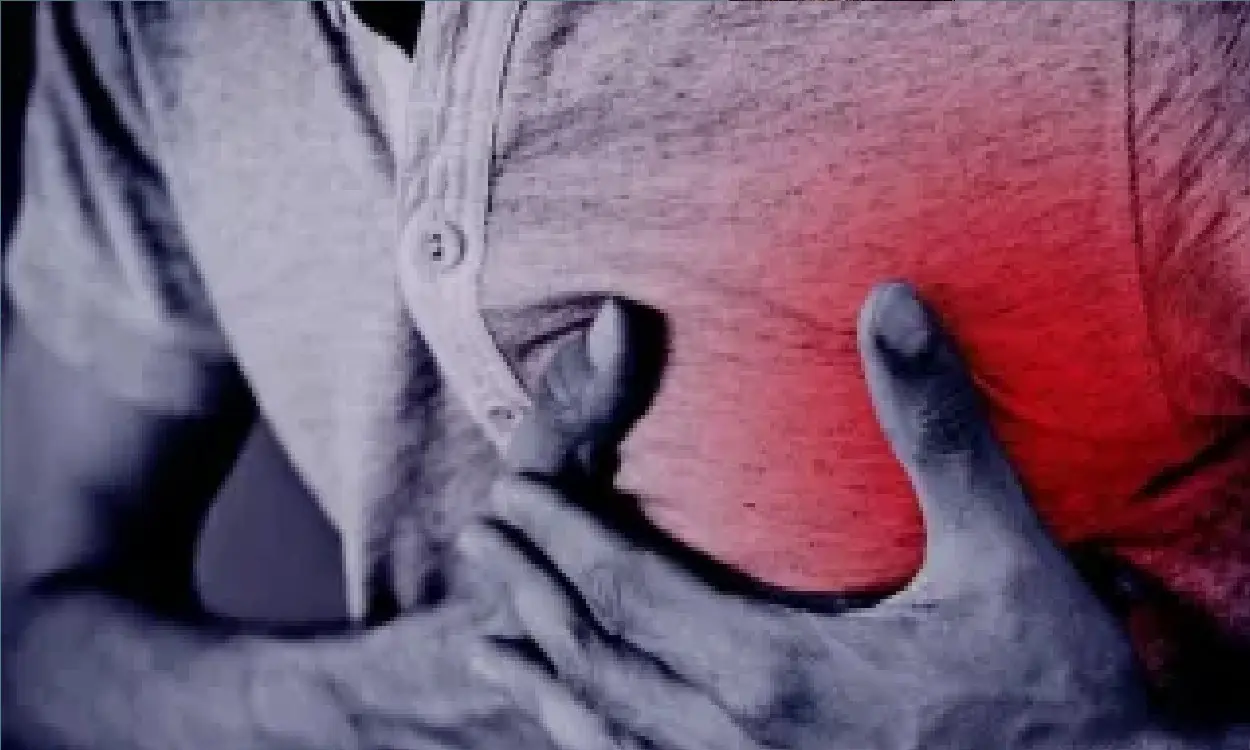 heart attack