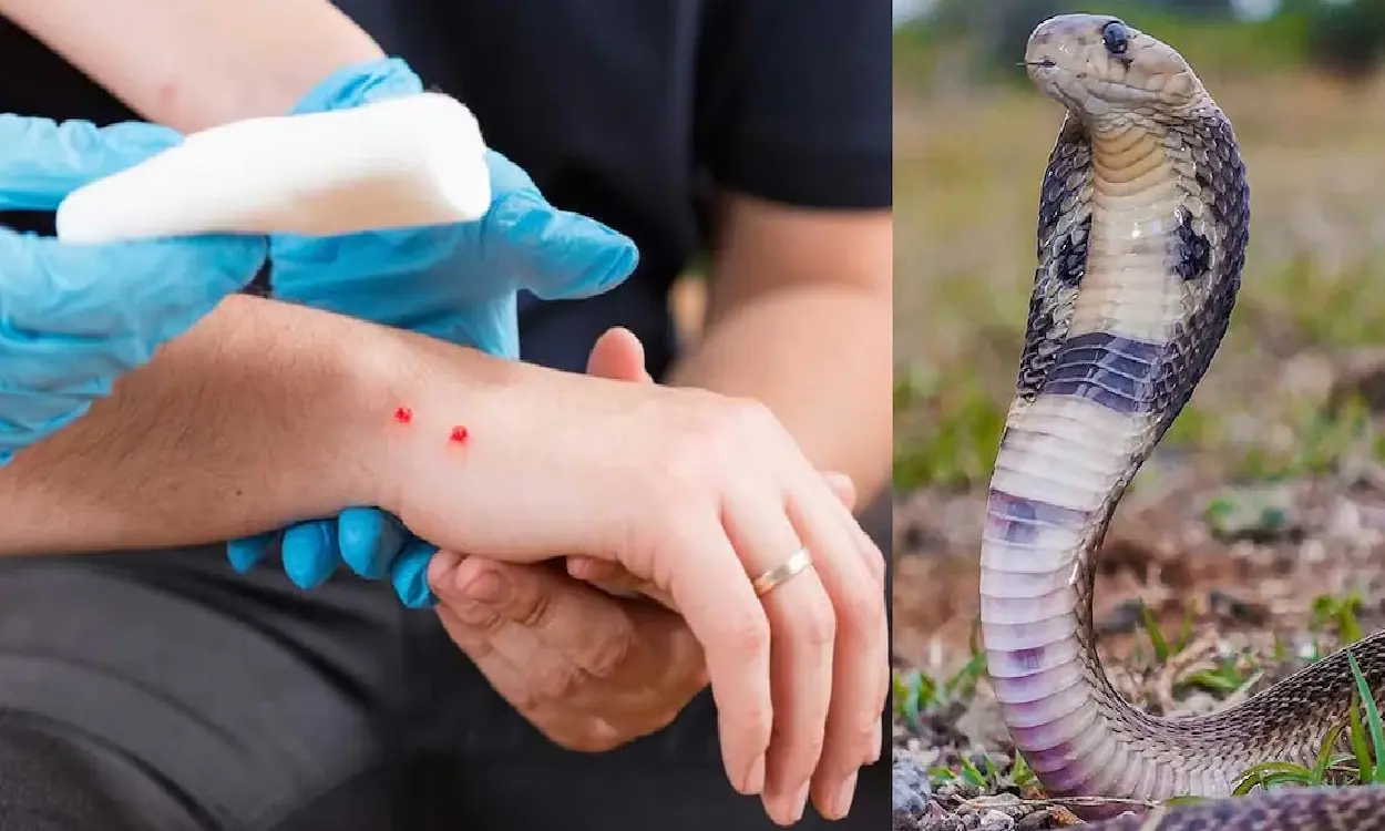 snake bite