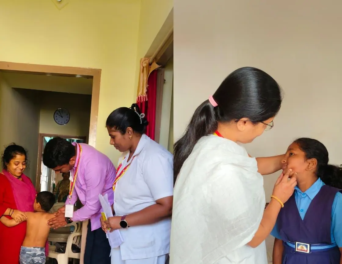 Shivamogga Leprosy can be prevented through early detection and appropriate treatment