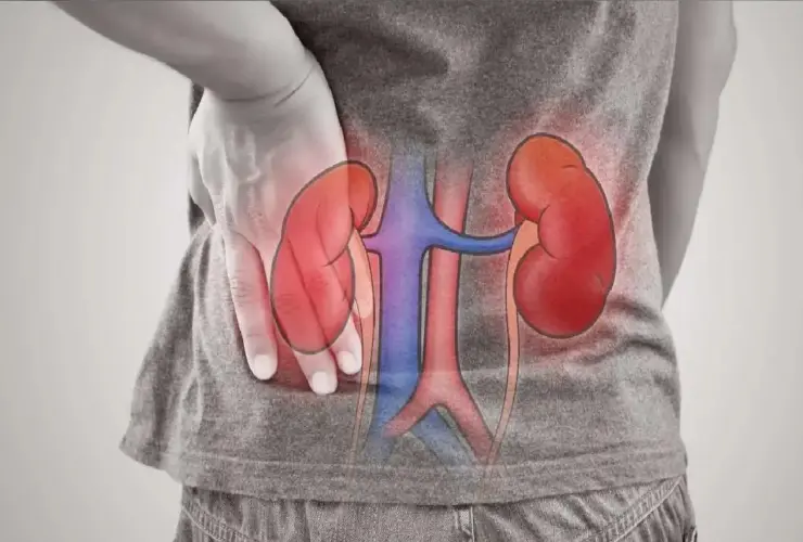 kidney problem