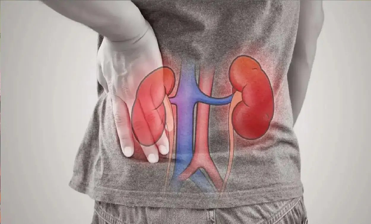 kidney problem