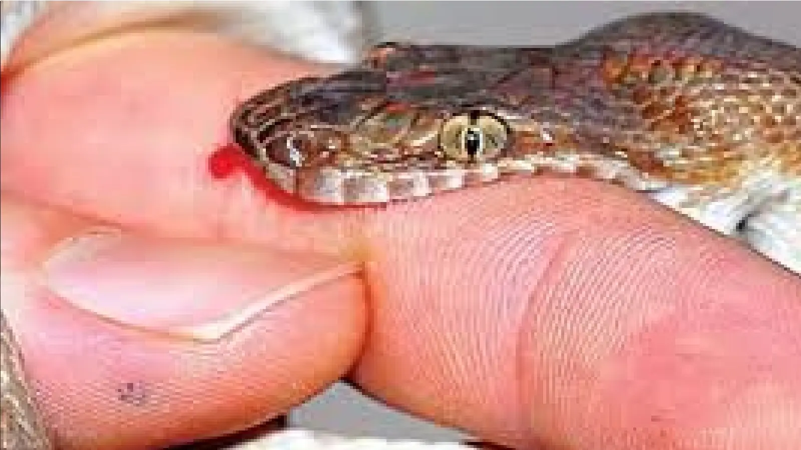 Don't worry if a snake bites you, just do this and you can save your life