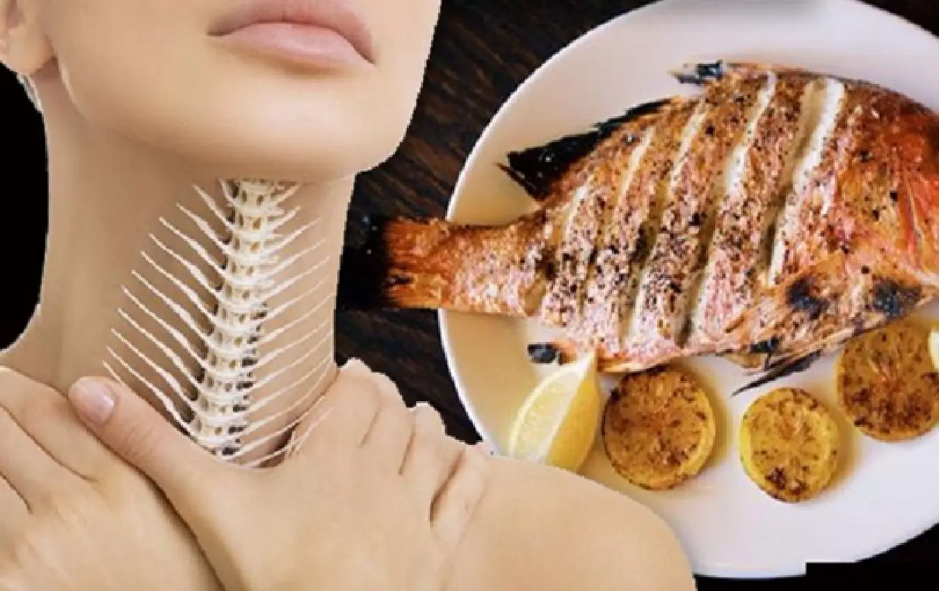 Fish thorn in the throat