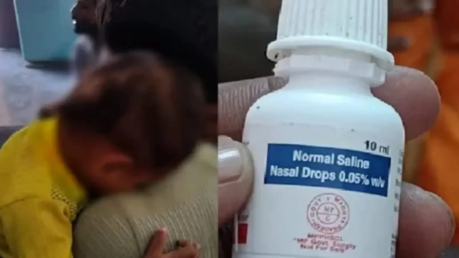 Toddler suffering due to medical negligence in Madhya Pradesh.